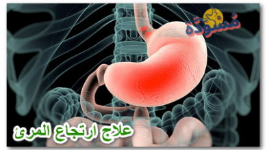 علاج ارتجاع المرئ